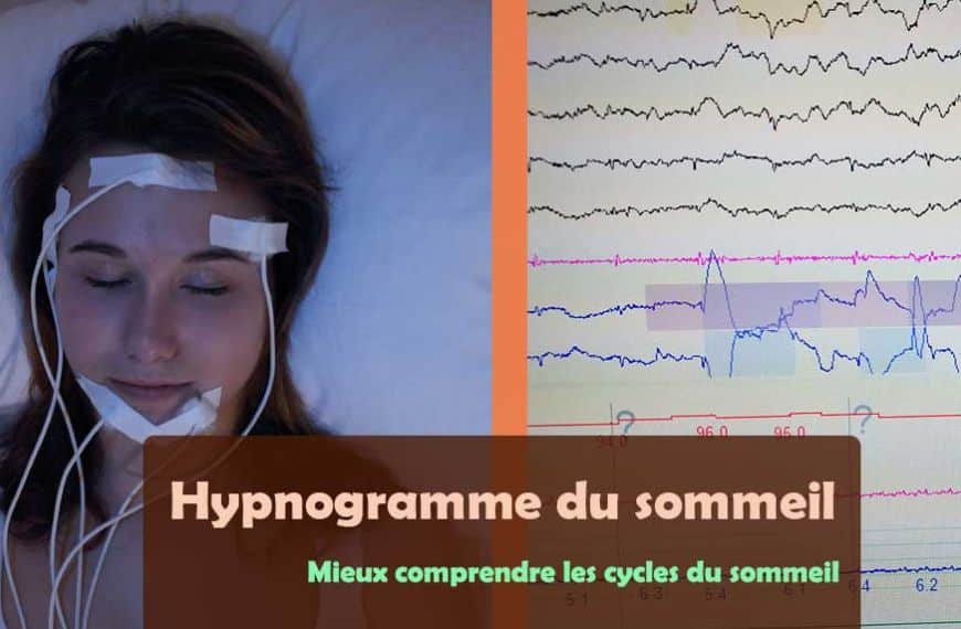 Hypnogramme du sommeil : mieux comprendre les cycles du sommeil