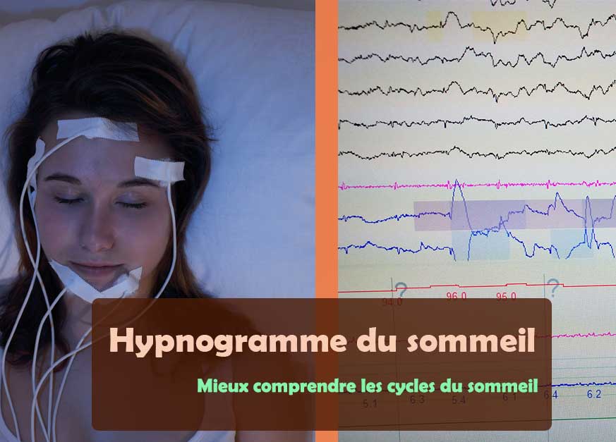 Hypnogramme du sommeil : mieux comprendre les cycles du sommeil - Les ...