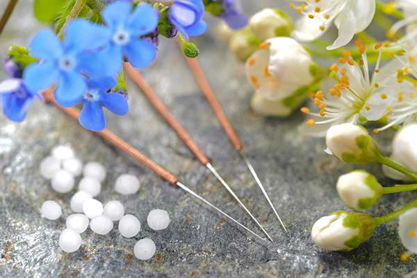 Acupuncture